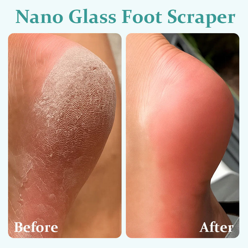Nano Glass Foot Scraper For Exfoliating Dead Skin
